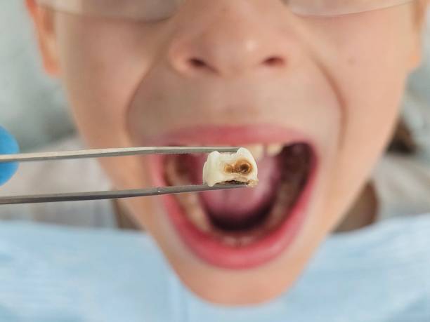 Best Cracked Tooth Emergency Dentist  in Lordship, CT