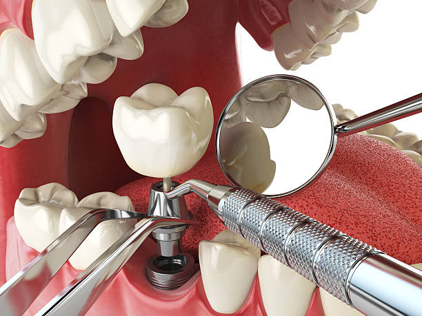 Best Cracked Tooth Emergency Dentist  in Lordship, CT